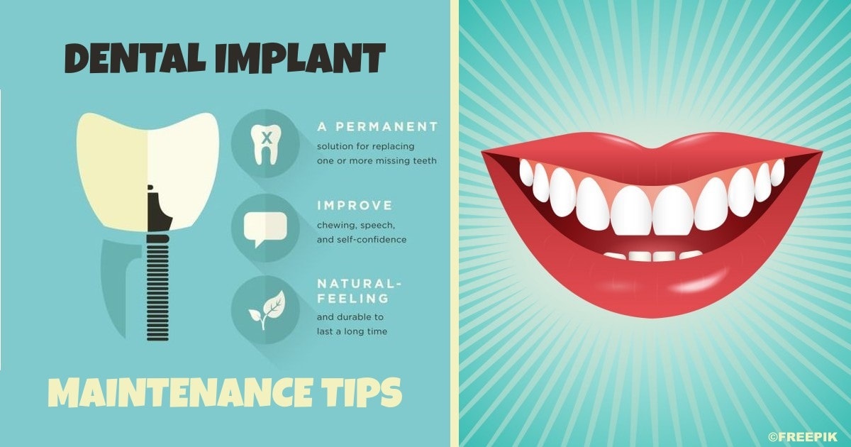 HOW TO AVOID COMMON DENTAL IMPLANTS PROBLEMS